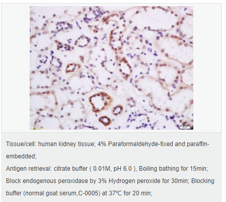 6052a74ca1762.png image.png