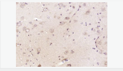 6052ad97b13a7.png image.png