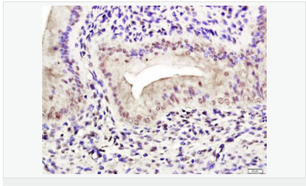 6052b99497f10.png image.png