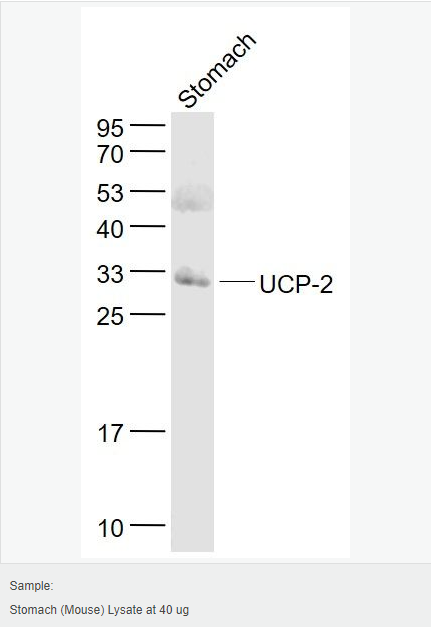 6052be5d6169f.png image.png