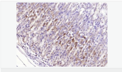 605416cd6837c.png image.png