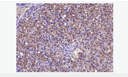 60544faf0a5bb.png image.png