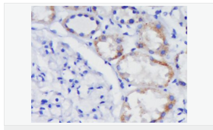 605812b0e22d9.png image.png