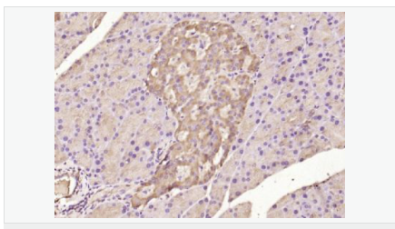 6058358b76204.png image.png