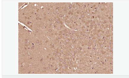 605855e2e175c.png image.png