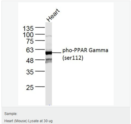 605952cd71667.png image.png