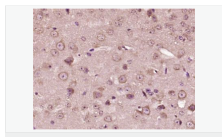 6059535bcfccd.png image.png