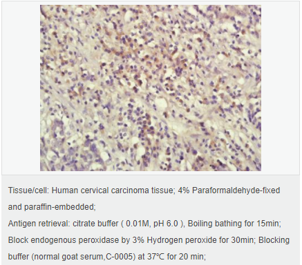 605953c3a5a29.png image.png