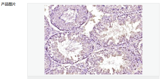 6063cf41b88d7.png image.png