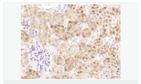 606572b18582d.png image.png