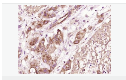 6076496a102be.png image.png